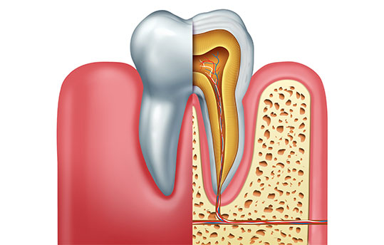 Test & Diagnosis for Root Canal