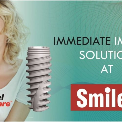 Need A Dental Implant?Read This First!
