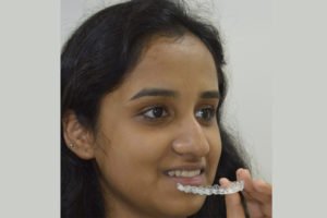 Removal Invisalign Invisible Braces in Pune
