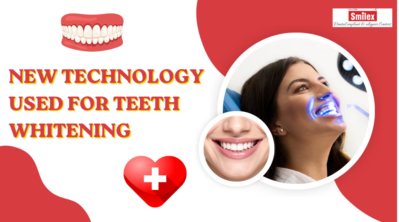 New Technology Used for Teeth Whitening