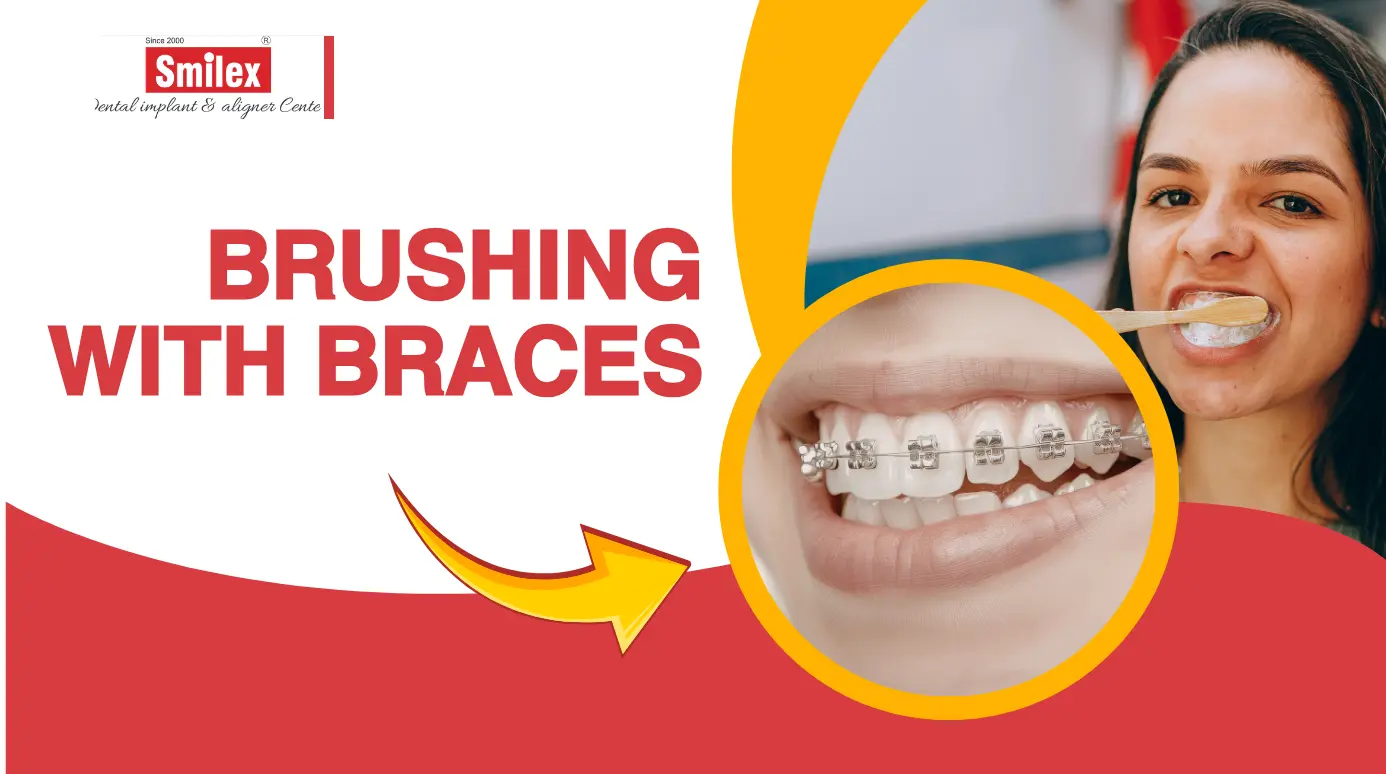 Brushing with Braces