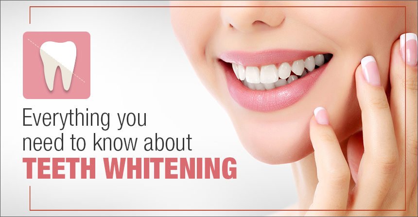 Everything you need to know about teeth whitening