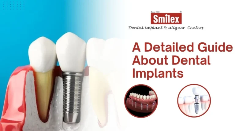 Dental Implants