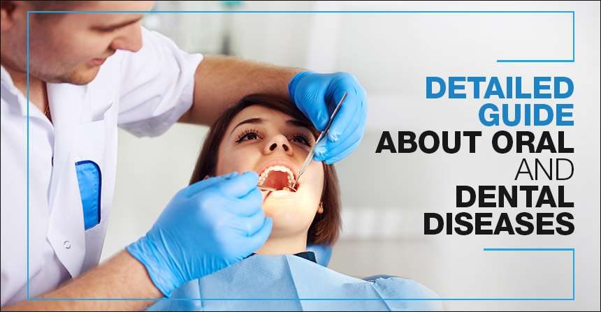 A Detailed Guide About Oral and Dental Diseases