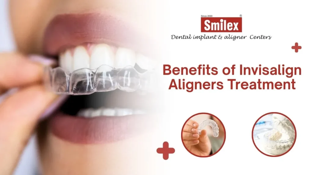 eating drinking with invisalign 2