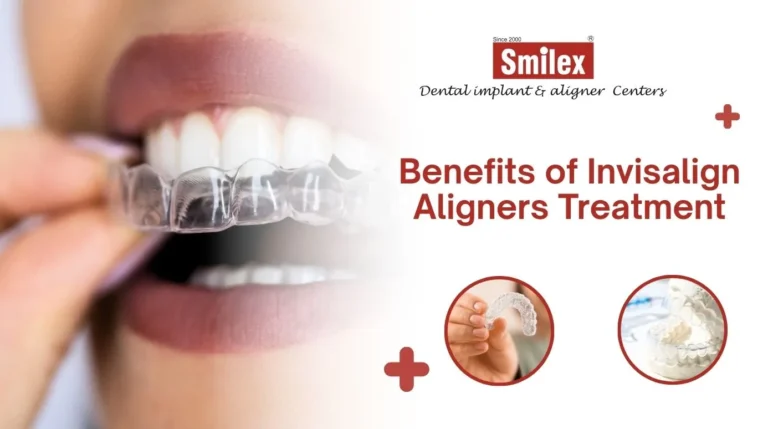 Invisalign Aligners Treatment
