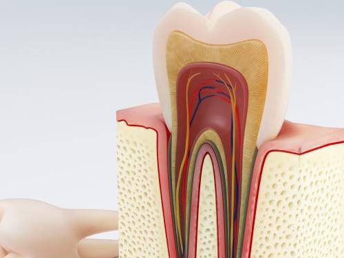 Answers to every question about Root Canal Treatment