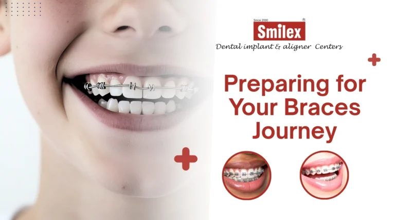 Braces Journey