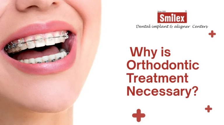 Orthodontic Treatment