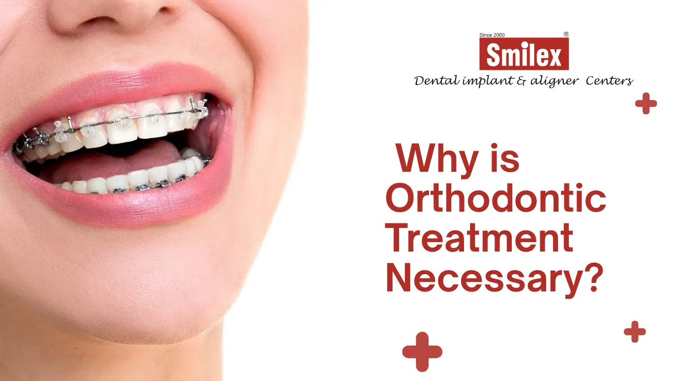 Orthodontic Treatment
