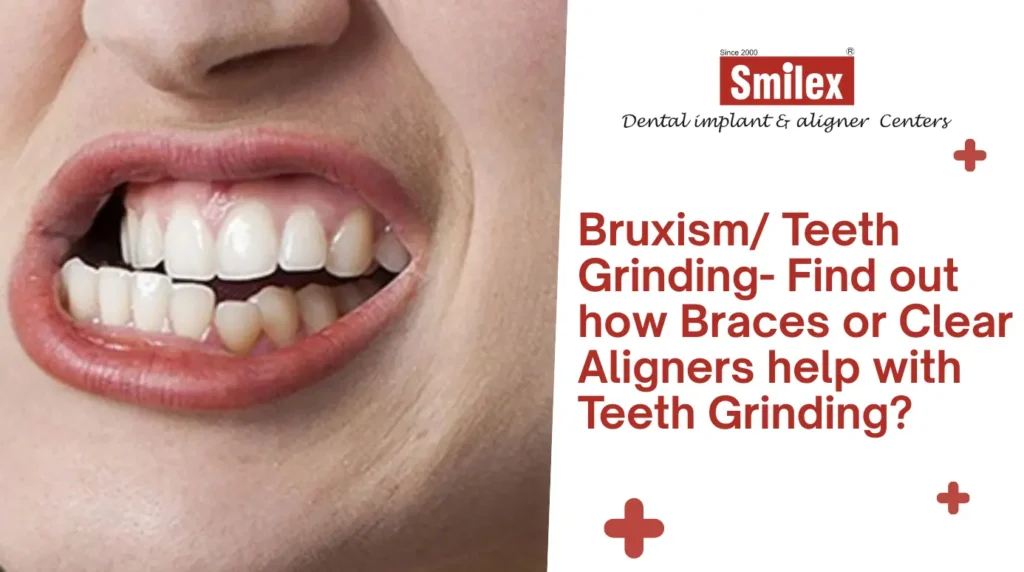 eating drinking with invisalign 5 2
