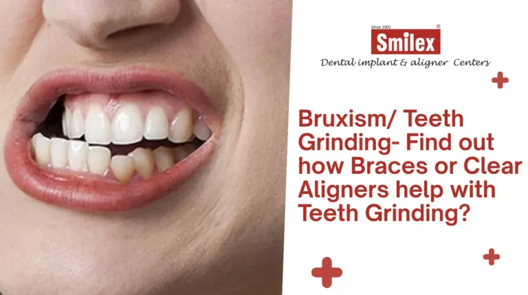 Bruxism/ Teeth Grinding