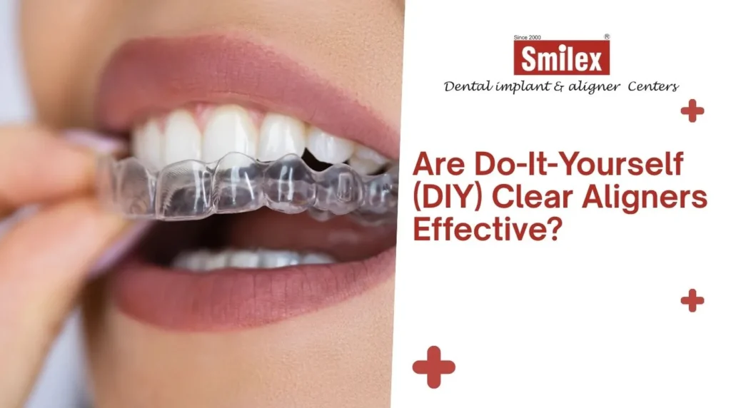 eating drinking with invisalign 5 4