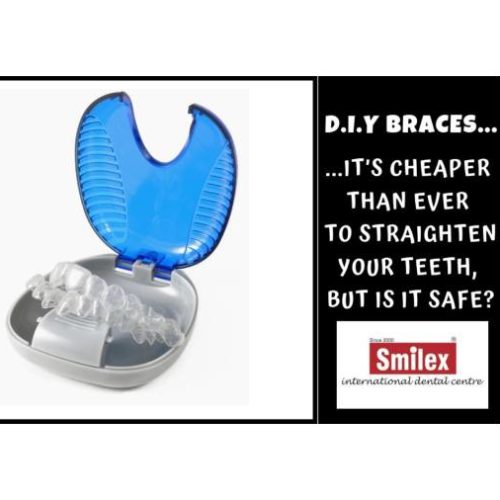 Are Do-It-Yourself  (DIY) Clear Aligners Effective?