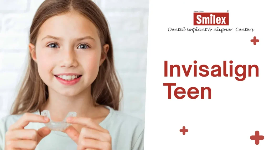 eating drinking with invisalign 6 (1)