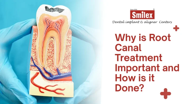 Root Canal Treatment in Pune