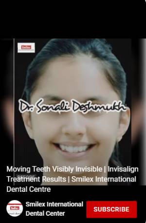 Clear Aligners Visibly Invisible Moving Teeth Image 1