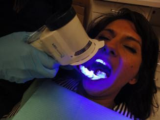 Oral Cancer Detection| Smilex
