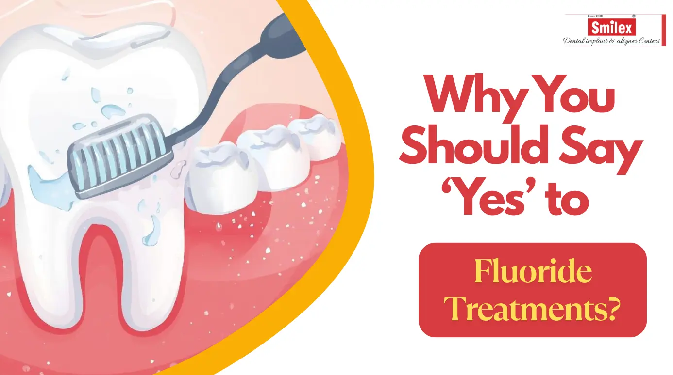 fluoride treatments