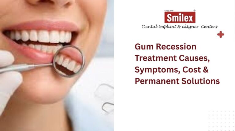 gum-recession-treatment