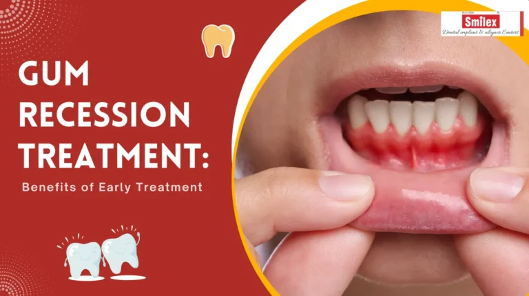 Gum Recession Treatment