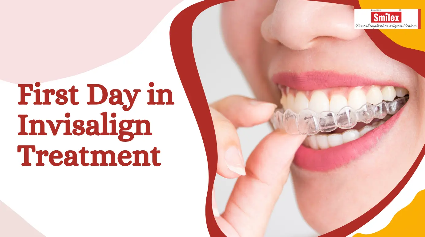 Invisalign Treatment