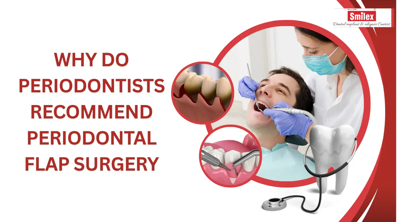 Why Do Periodontists Recommend Periodontal Flap Surgery
