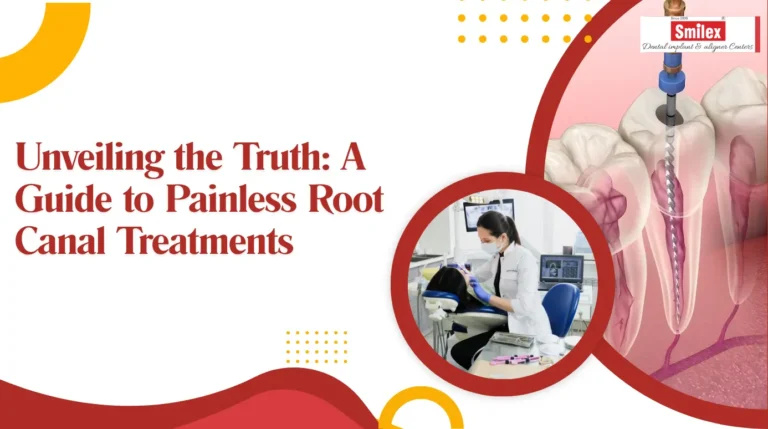 Root Canal Treatments