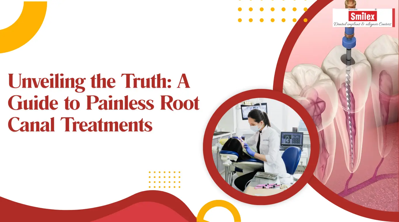 Root Canal Treatments