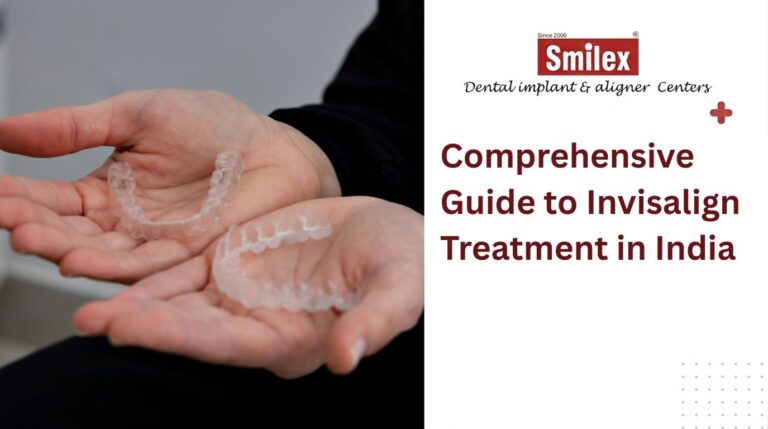 Invisalign Treatment in India