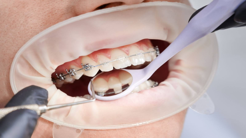Enhance Your Smile with the Best Orthodontist in Pune