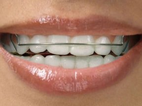 best orthodontic clinic in Pune