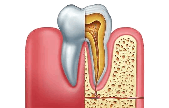 Test & Diagnosis for Root Canal