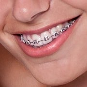 top orthodontist near me