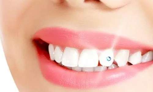 Tooth Jewellery