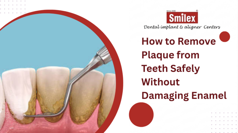 How to Remove Plaque from Teeth Safely