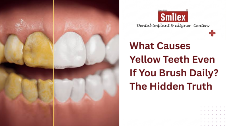 what-causes-yellow-teeth