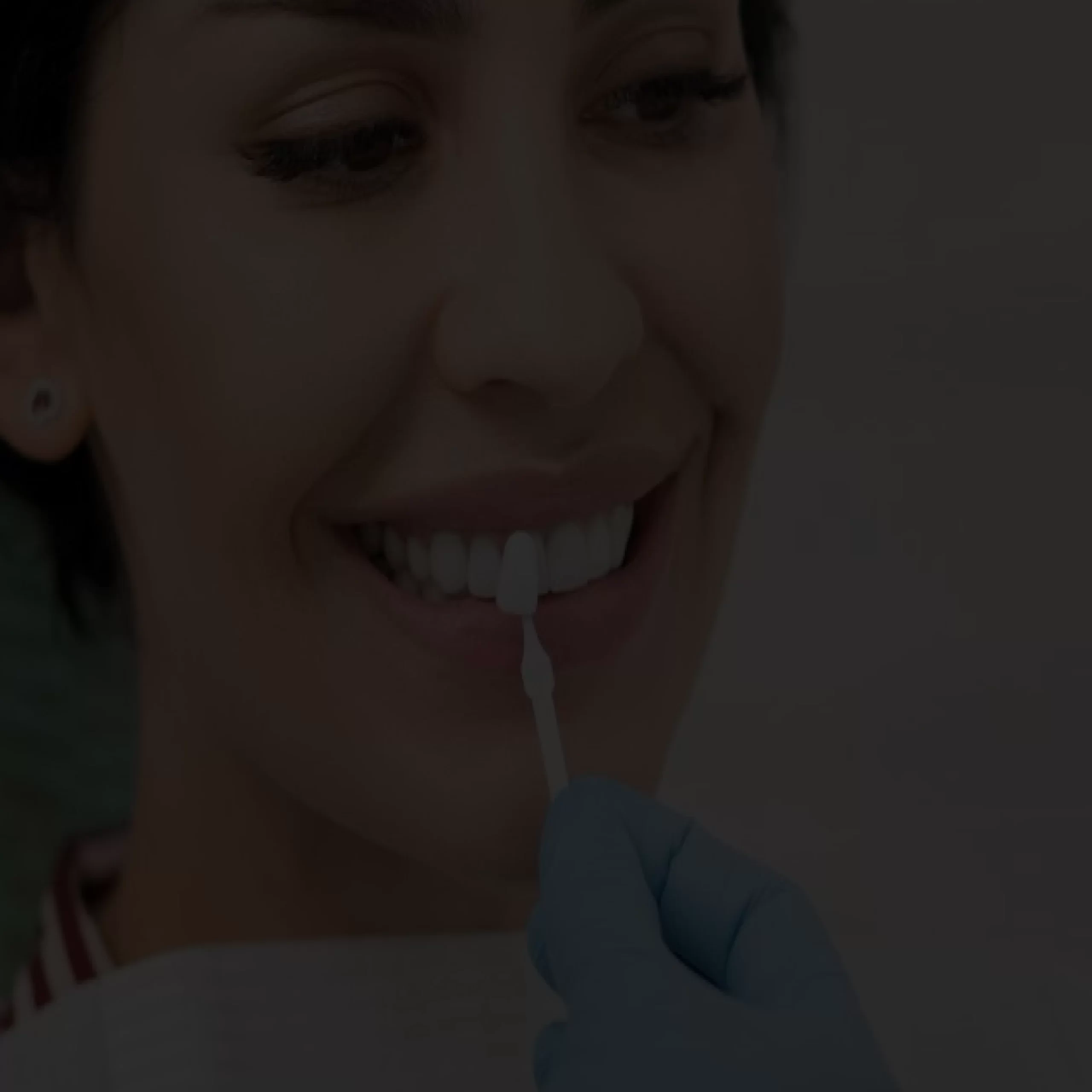Teeth Whitening