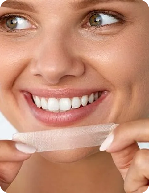 Take Home Teeth Whitening