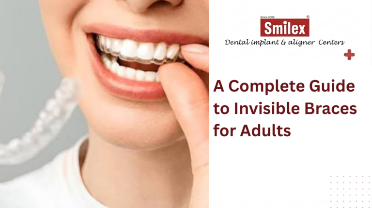 Invisible Braces for Adults