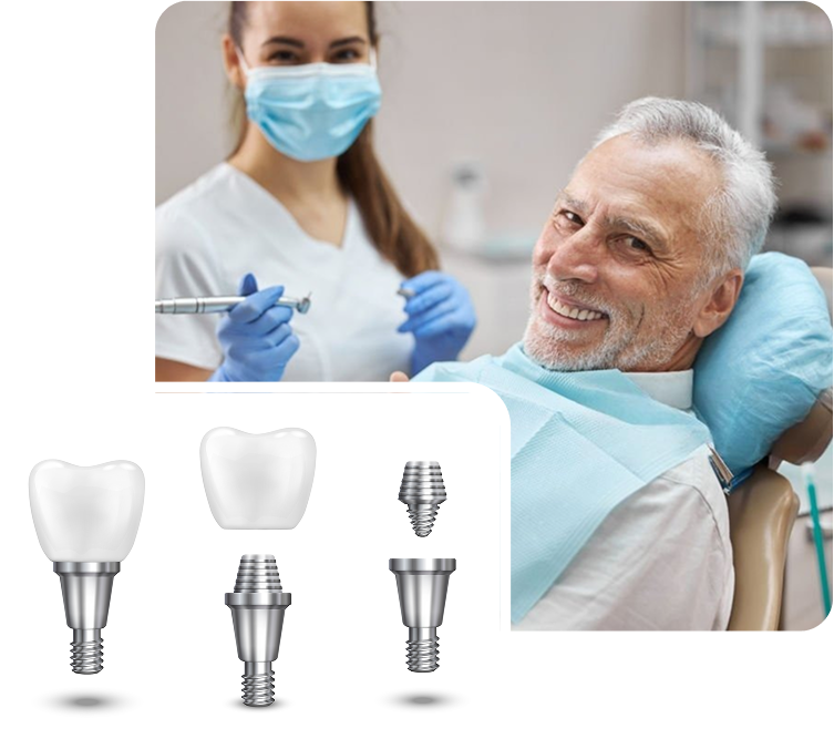 All-on-4 Dental Implants