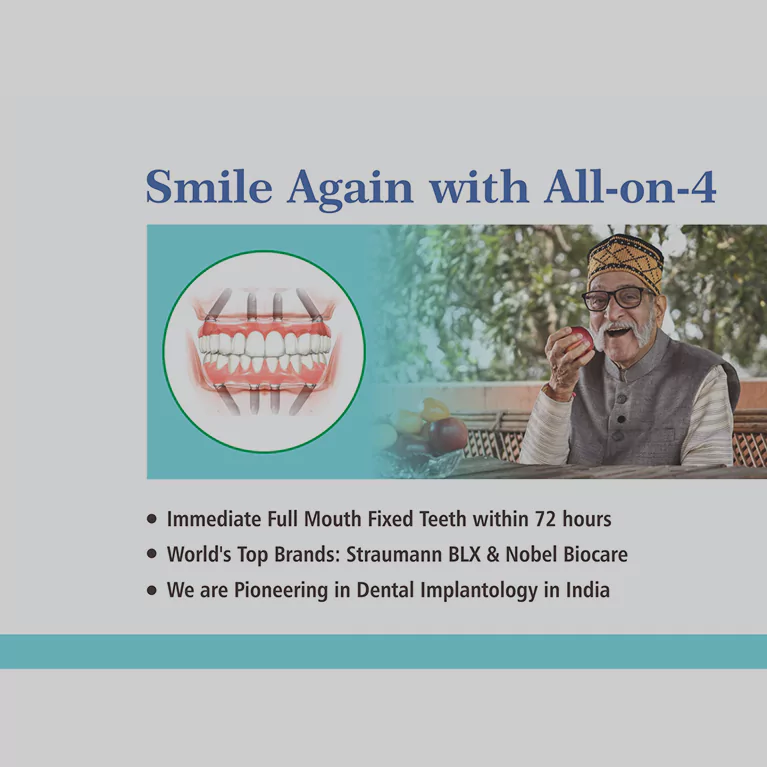 All-on-4 Dental Implants
