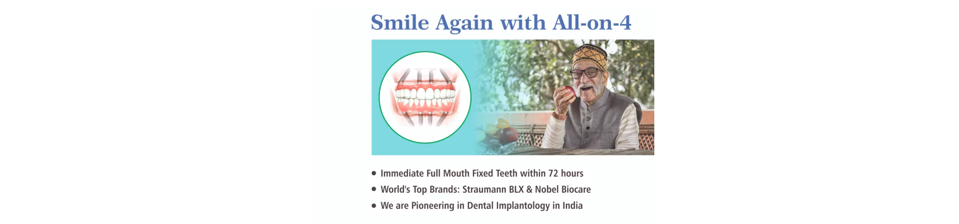 All-on-4 Dental Implants