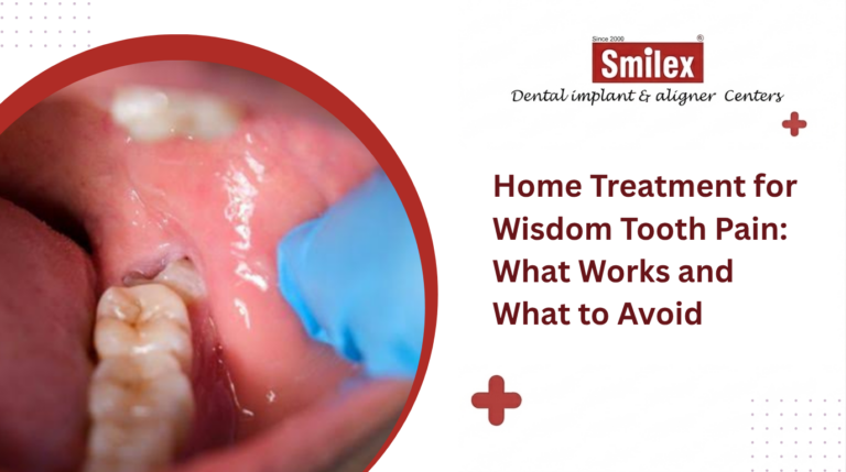 Home Treatment for Wisdom Tooth Pain