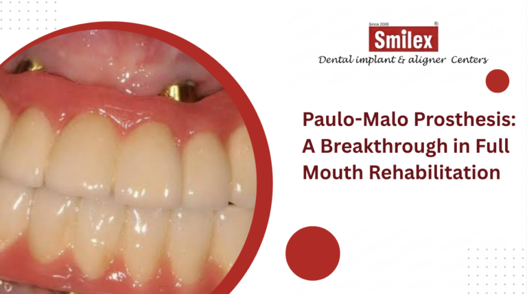 Paulo-Malo Prosthesis