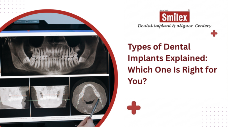 Dental Bridges vs Implants