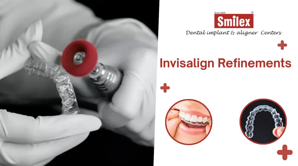 eating drinking with invisalign 1 1 1024x572