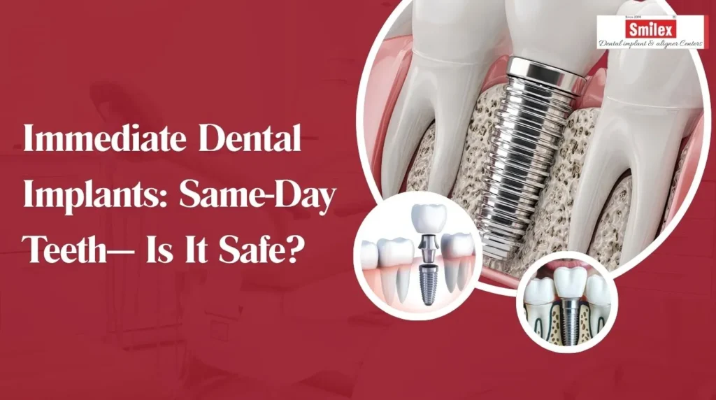 Immediate Dental Implants