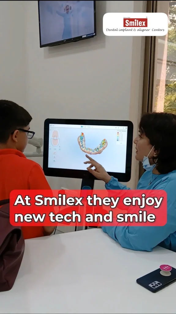 Invisalign Palatal Expander (IPE)