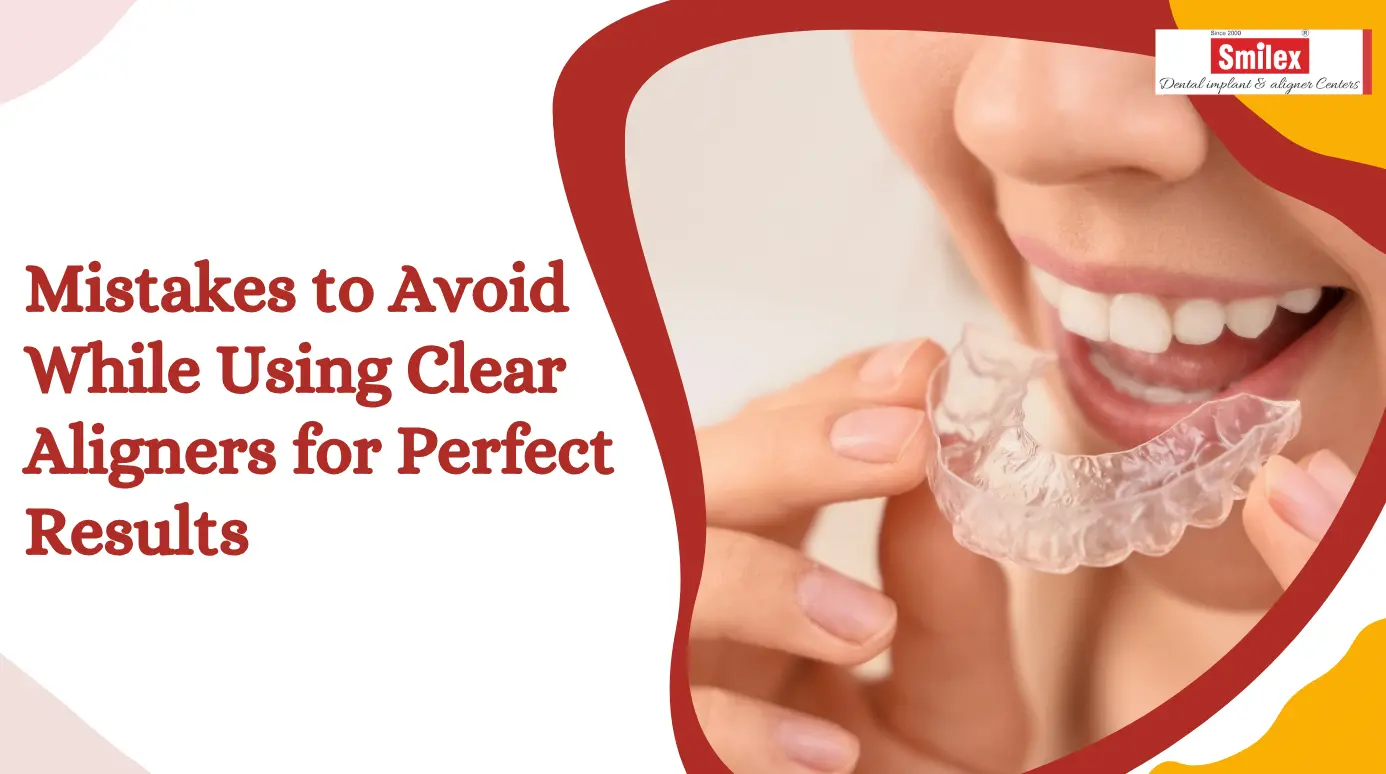 Mistakes to Avoid While Using Clear Aligners for Perfect Results